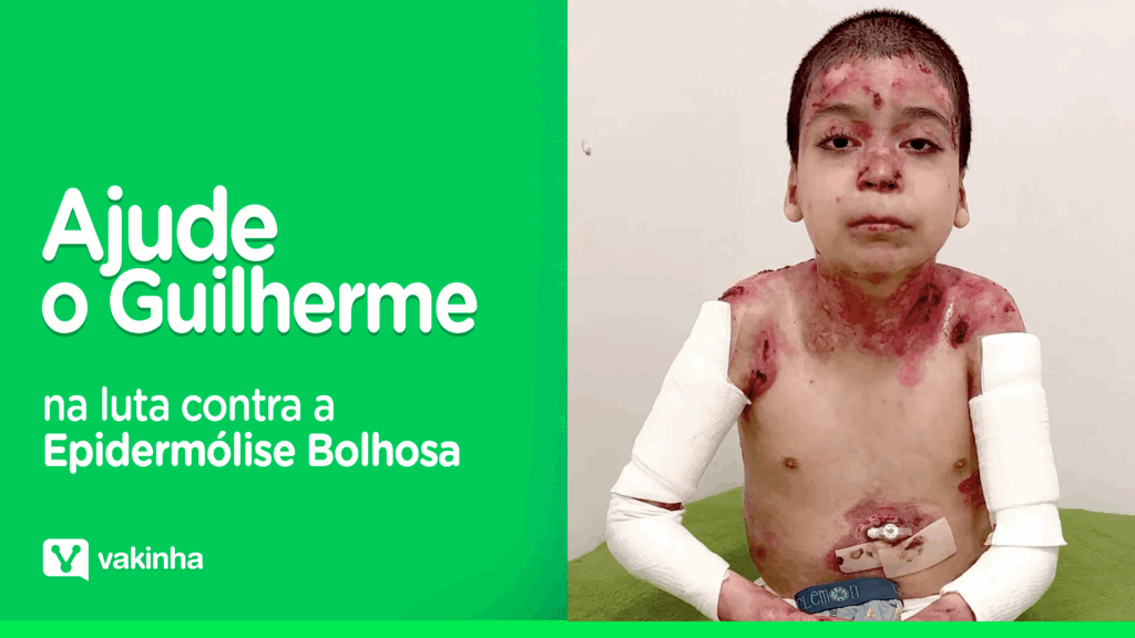 Banner da campanha Ajude o Guilherme